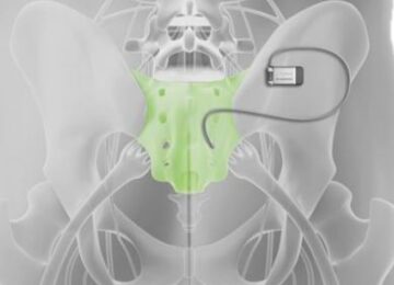 Axonics Boosts Battery  Life, Sales, Market Cap