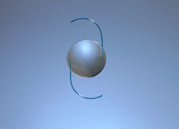 RxSight Up 11% on Preliminary Q4, Full Year Results