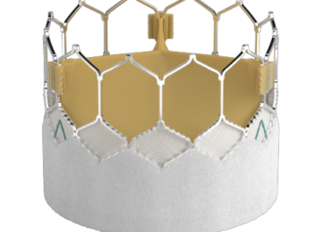 Hoag Participates in Study on Edwards’ Newest Technology