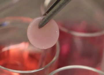 Jaw Joint Implant Co.  From UCI Awarded $6M Grant