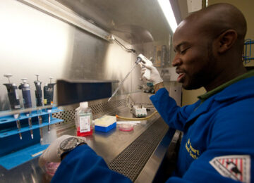 UCI Receives $6M Grant to Study Jaw Joint Implant