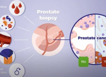 MDxHealth CEO Bullish After Q2 Revenue Boost