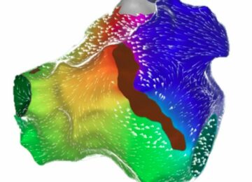 Biosense Webster Aims to Reduce Radiation Exposure