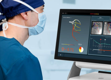 Medical Device Giant Plans $585M CathWorks Buy