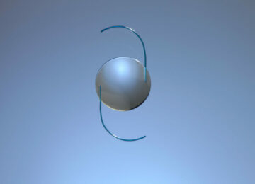 RxSight Plunges 33% on Revised Outlook