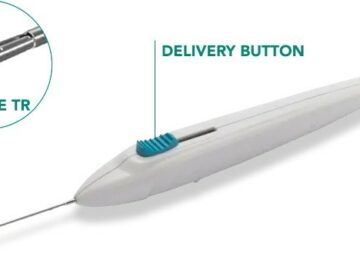 Glaukos, Tarsus, RxSight: Q4 Earnings Snapshot