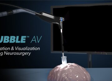 Viseon Expands into Neurosurgery Market with Hubble AV
