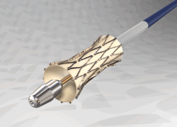 FDA Denies enVVeno Medical’s Appeal