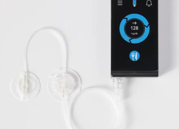 Beta Bionics 2-Year Revenue Jumps 736% to $103.2 Million