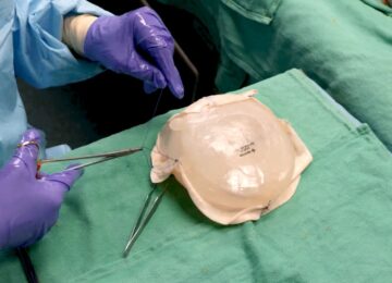 Irvine Anchors J&J MedTech’s Breast Aesthetics Unit