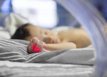 Masimo Data Backs Pulse Ox Accuracy in Newborns Across All Skin Tones