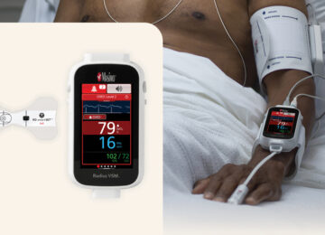 FDA Clears New Masimo Monitoring Feature